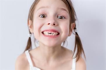 Ein kleines Mädchen macht ein lustiges Gesicht, weil ihr die Zähne fehlen.