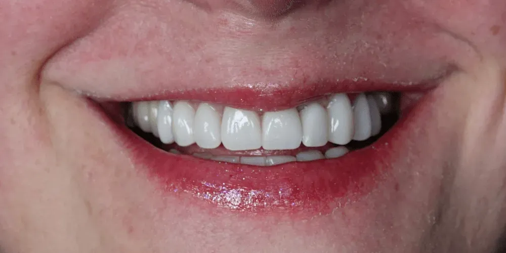 Primer plano de una boca sonriente con dientes blancos y lápiz labial rojo.