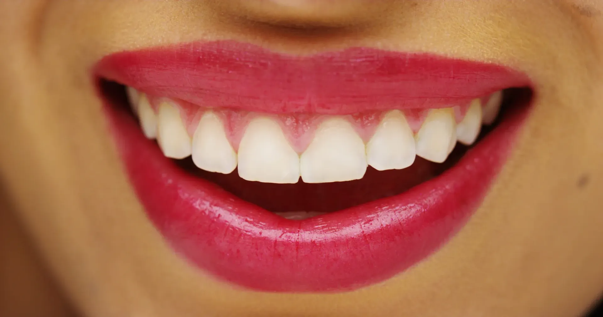 Primer plano de una boca sonriente con lápiz labial rojo brillante y dientes blancos.