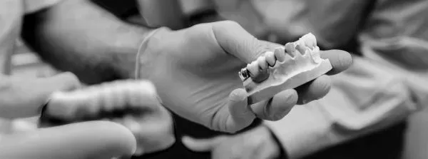 Manos sosteniendo un pequeño molde dental sobre un fondo fotográfico en blanco y negro.