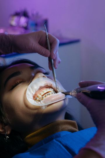 Una persona que recibe tratamiento de ortodoncia con un retractor bucal 