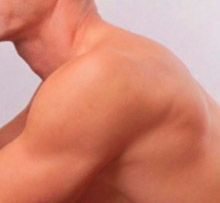 Hombro y parte superior del brazo desnudos, con piel suave y clara sobre un fondo blanco.