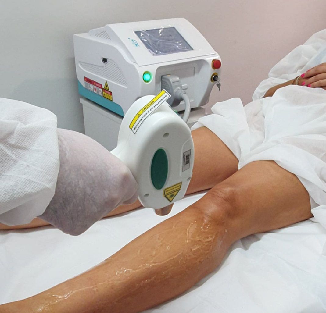 Pierna sometida a depilación láser; el técnico utiliza un dispositivo con cuerpo blanco y detalles verdes.