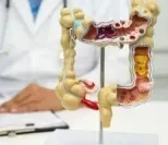 A doctor is looking at a model of the large intestine.