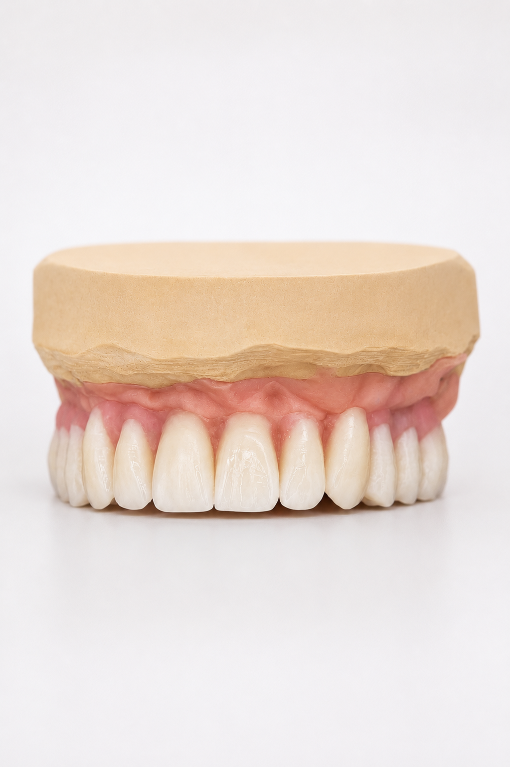 Des mains gantées tiennent un modèle dentaire avec un appareil orthodontique dans un espace de travail clinique