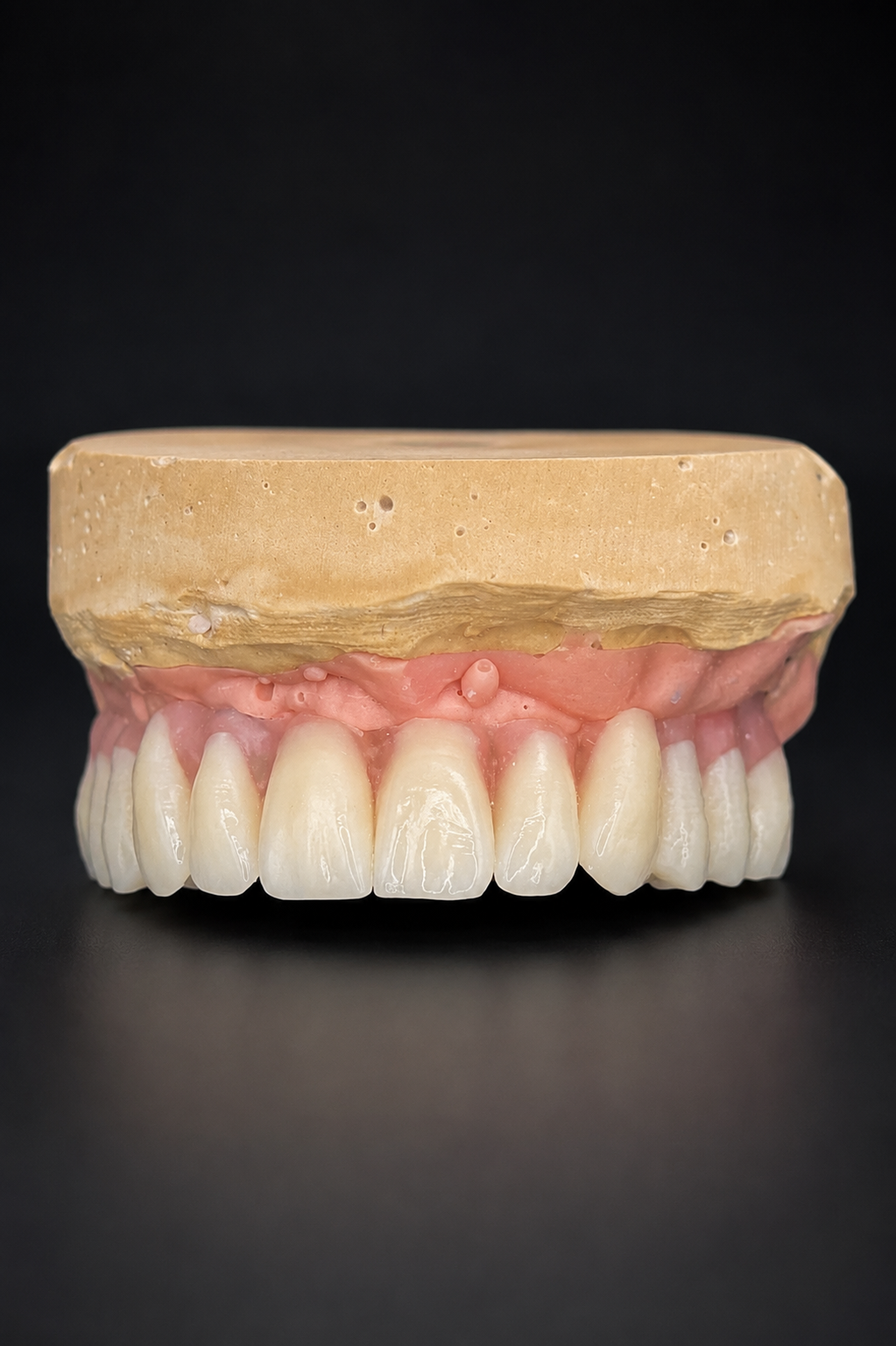 Des mains gantées tiennent un modèle dentaire avec un appareil orthodontique dans un espace de travail clinique