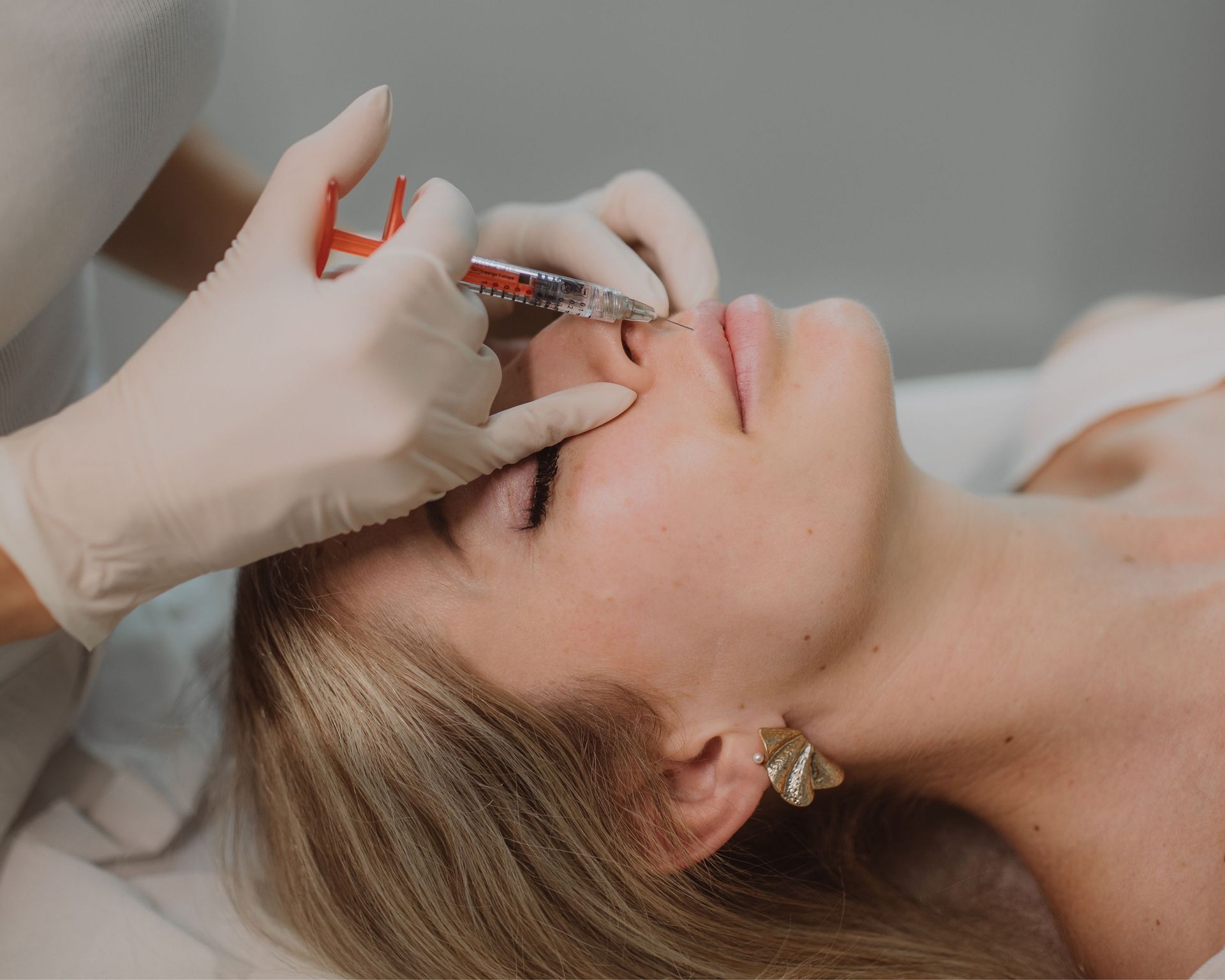 Frau erhält eine Lippeninjektion mit einer Spritze durch eine Person mit Handschuhen