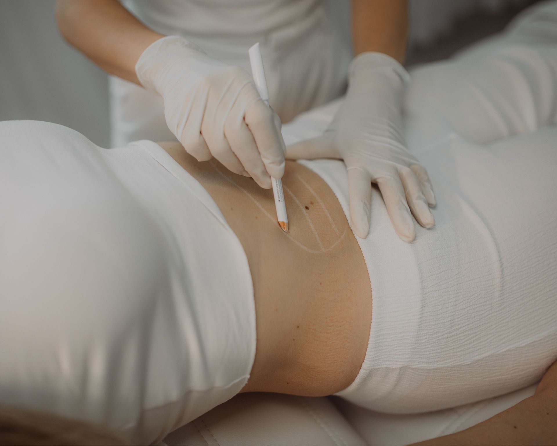 Medizinische Fachkraft markiert mit Stift Bereich auf Bauch einer liegenden Person in weißer Kleidung