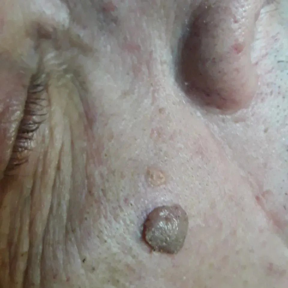 Hoitola Virvatuli
