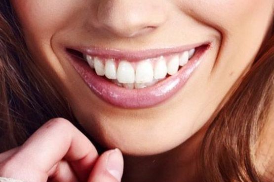 Primer plano de una boca sonriente, con dientes blancos y labios rosados, y una mano cerca de la barbilla