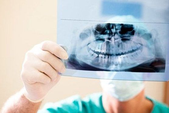 Dentista sosteniendo una radiografía panorámica de los dientes y la mandíbula en una clínica