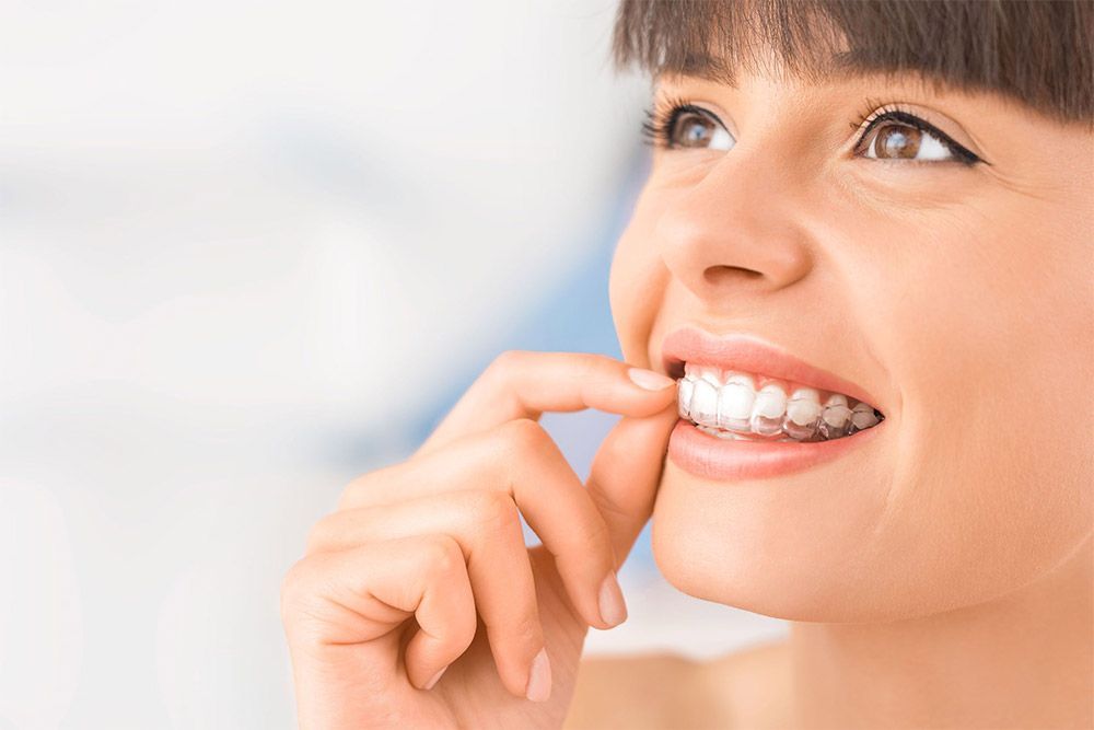 Primer plano de una persona sonriente ajustándose los brackets transparentes con un dedo