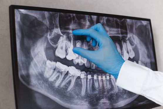 Röntgen - ZahnärzteTeam Ort - Hirzel