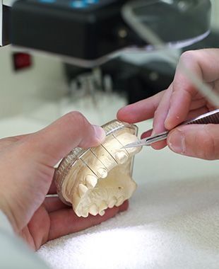 Manos sosteniendo un molde de yeso dental y herramientas dentales, trabajando en modelos de dientes.