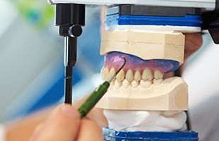 Técnico dental ajustando un molde dental con una herramienta, centrándose en los dientes y las encías.