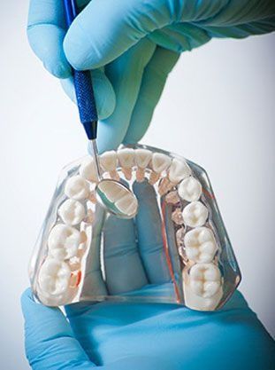 Manos con guantes azules sosteniendo un espejo dental sobre un modelo de dientes.