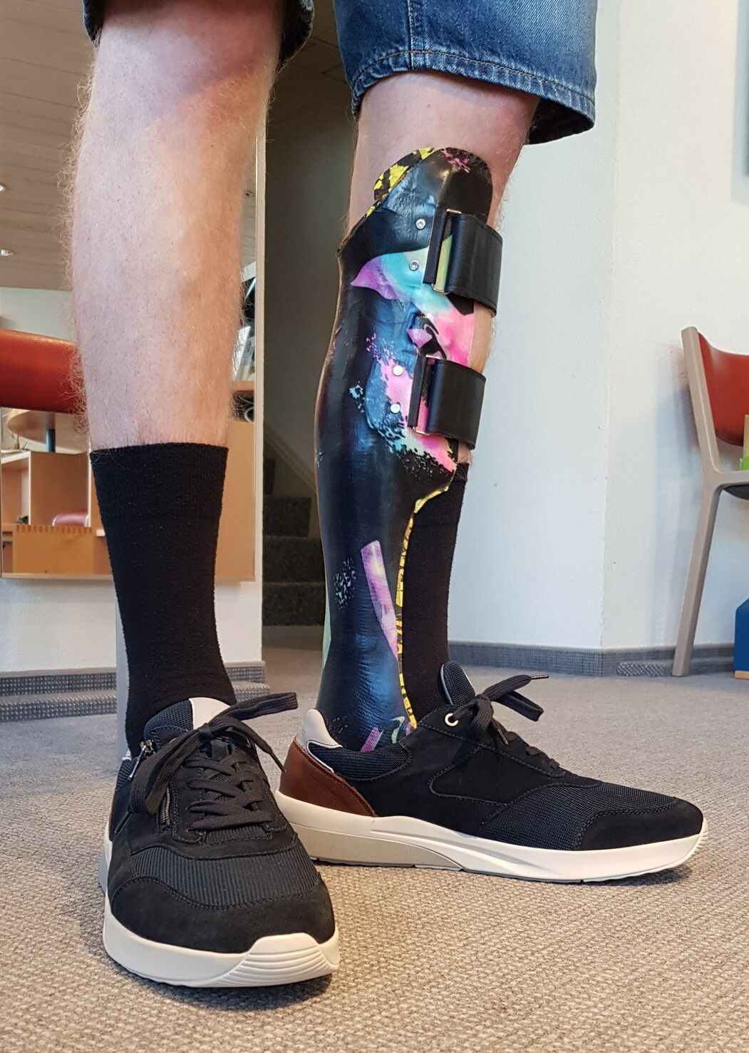 Eine Person mit einer Beinprothese trägt schwarze Schuhe.