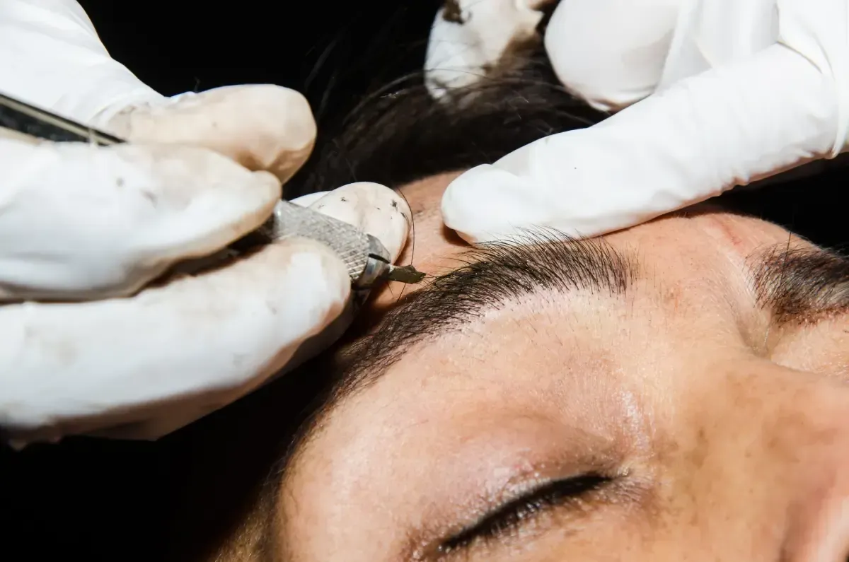 Manos en guantes realizando microblading de cejas en la frente de una persona.