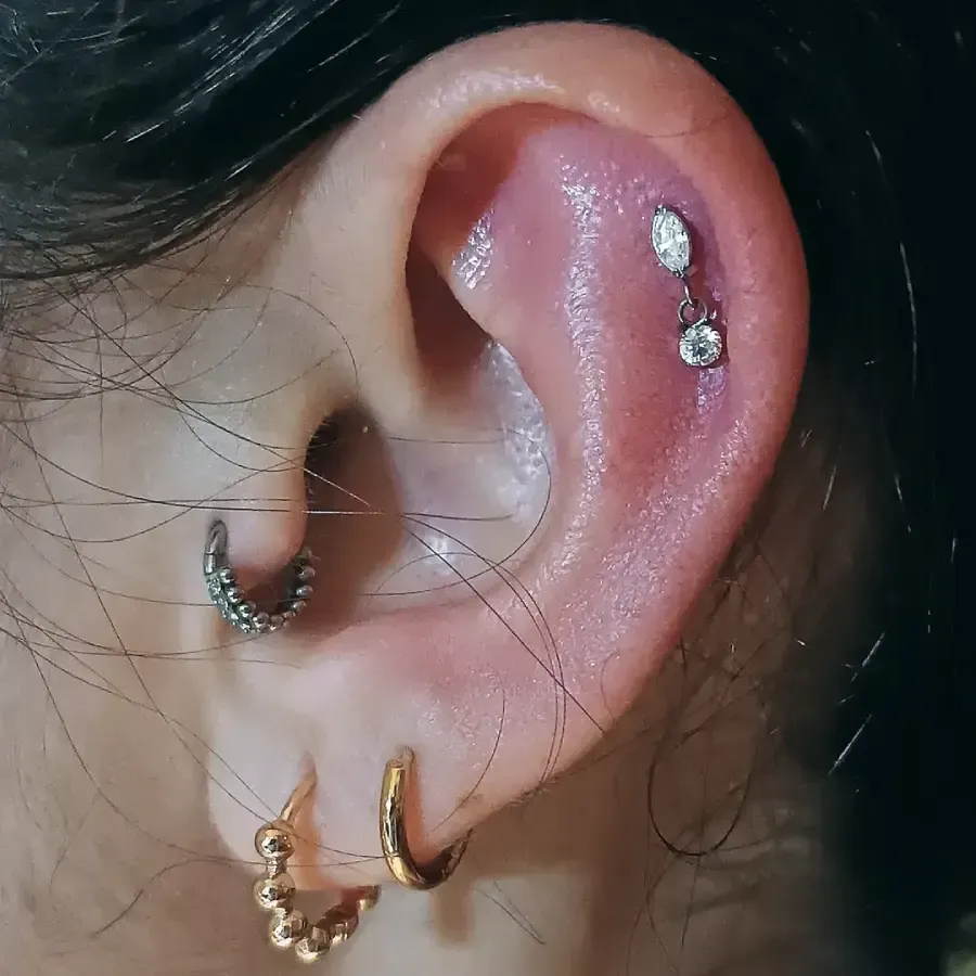 Oreja con múltiples perforaciones; son visibles las perforaciones en el hélix y el lóbulo.