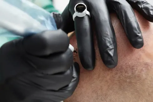 Manos con guantes negros utilizando una máquina de tatuar en la cara de alguien.