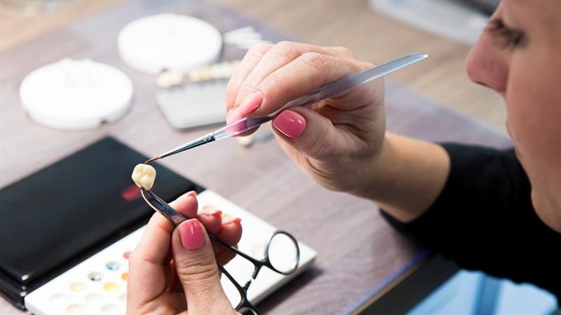 Eine Frau mit rosa Nägeln hält eine Pinzette über einen Zahn.