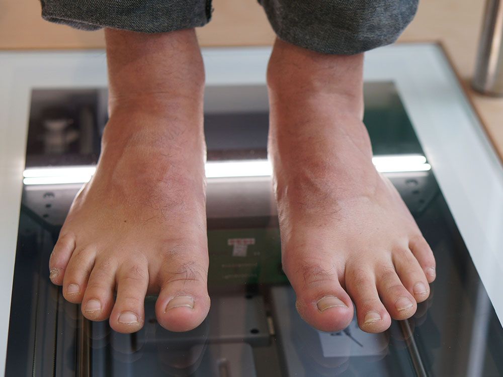 Die Füße einer Person werden auf einer Waage gemessen