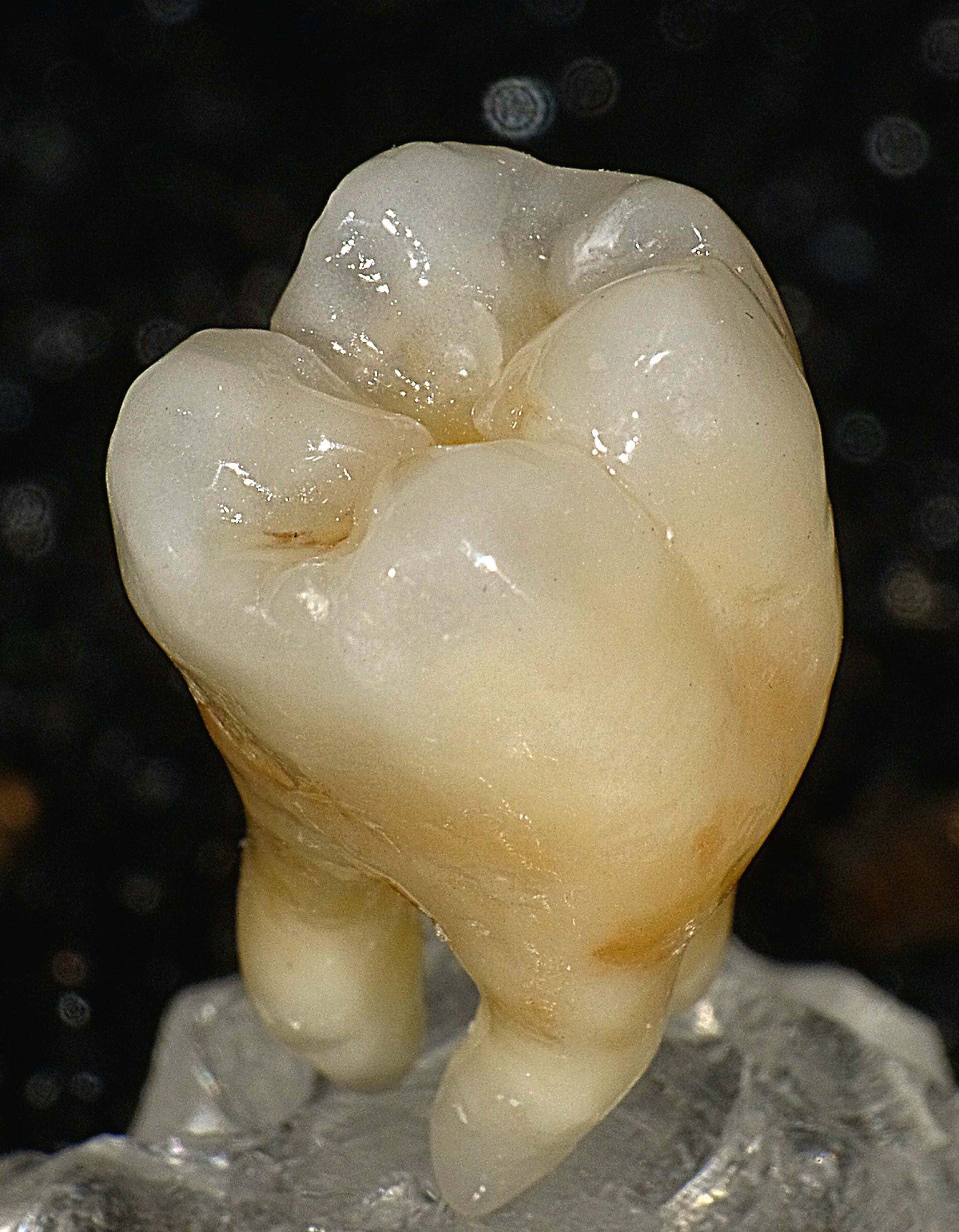 Eine Nahaufnahme eines Zahns mit schwarzem Hintergrund