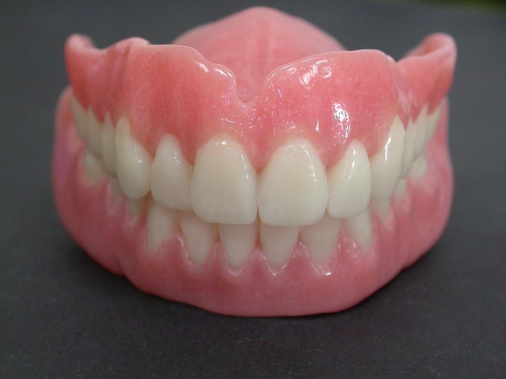 Oberkiefer + Unterkiefer Totalprothese - Daniel Wirz Zahnprothetik