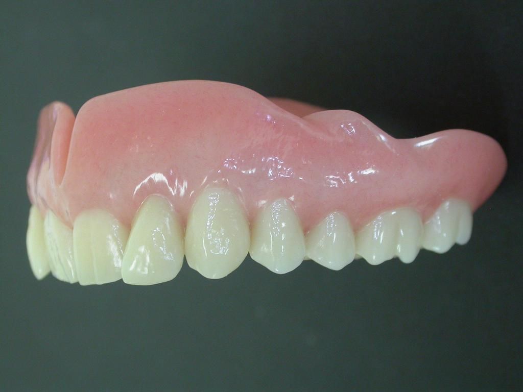 Oberkiefer Totalprothese - Daniel Wirz Zahnprothetik - Zürich