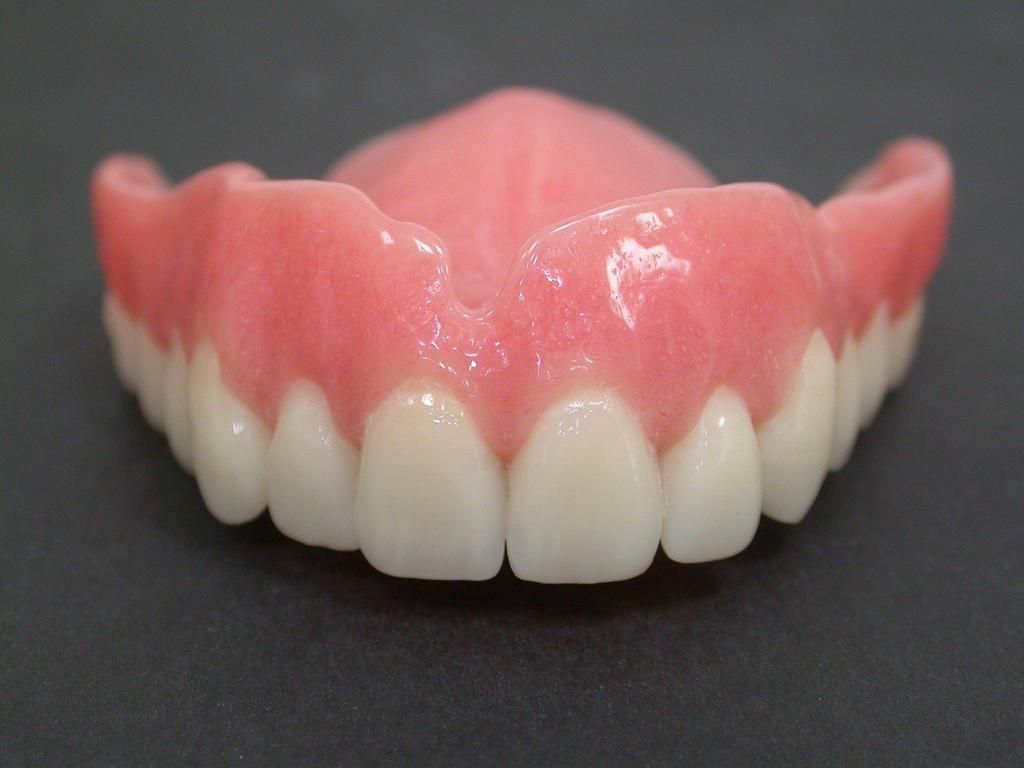 Oberkiefer Totalprothese - Daniel Wirz Zahnprothetik - Zürich