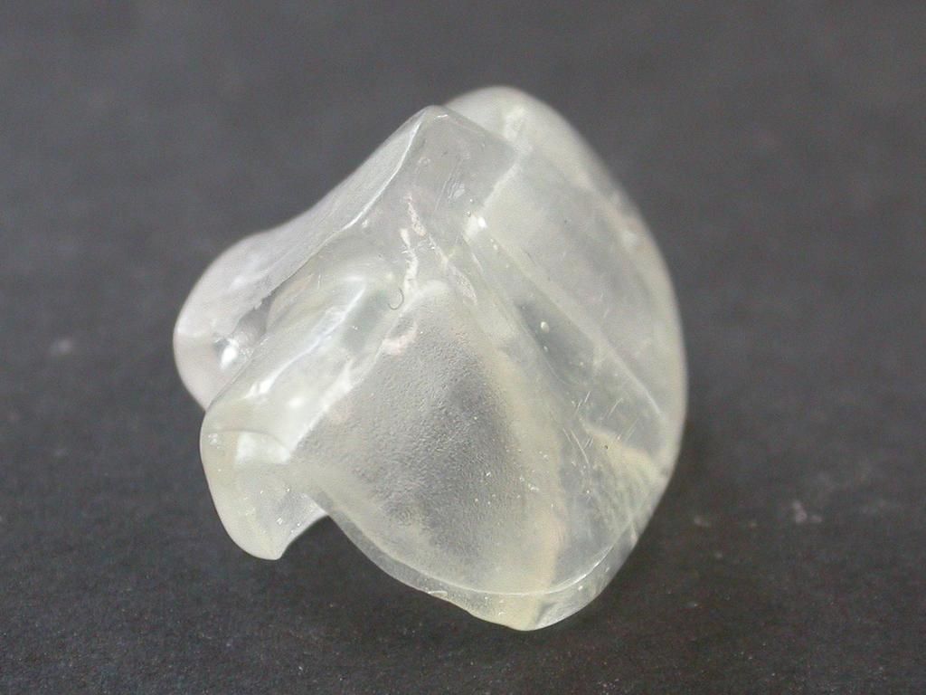 NTI-tss - Aufbissschiene - Daniel Wirz - Zahnprothetiker - Zürich