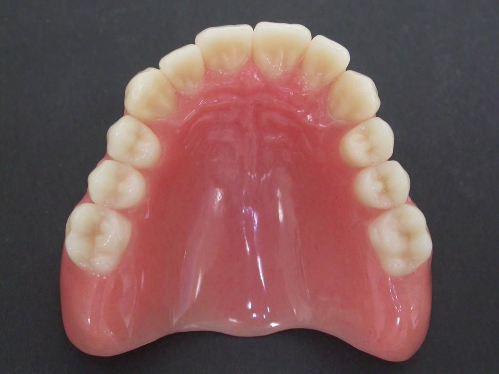 Oberkiefer Totalprothese - Daniel Wirz Zahnprothetik - Zürich