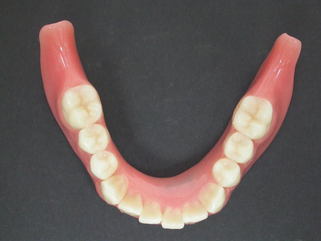 Unterkiefer Totalprothese - Daniel Wirz Zahnprothetik - Zürich