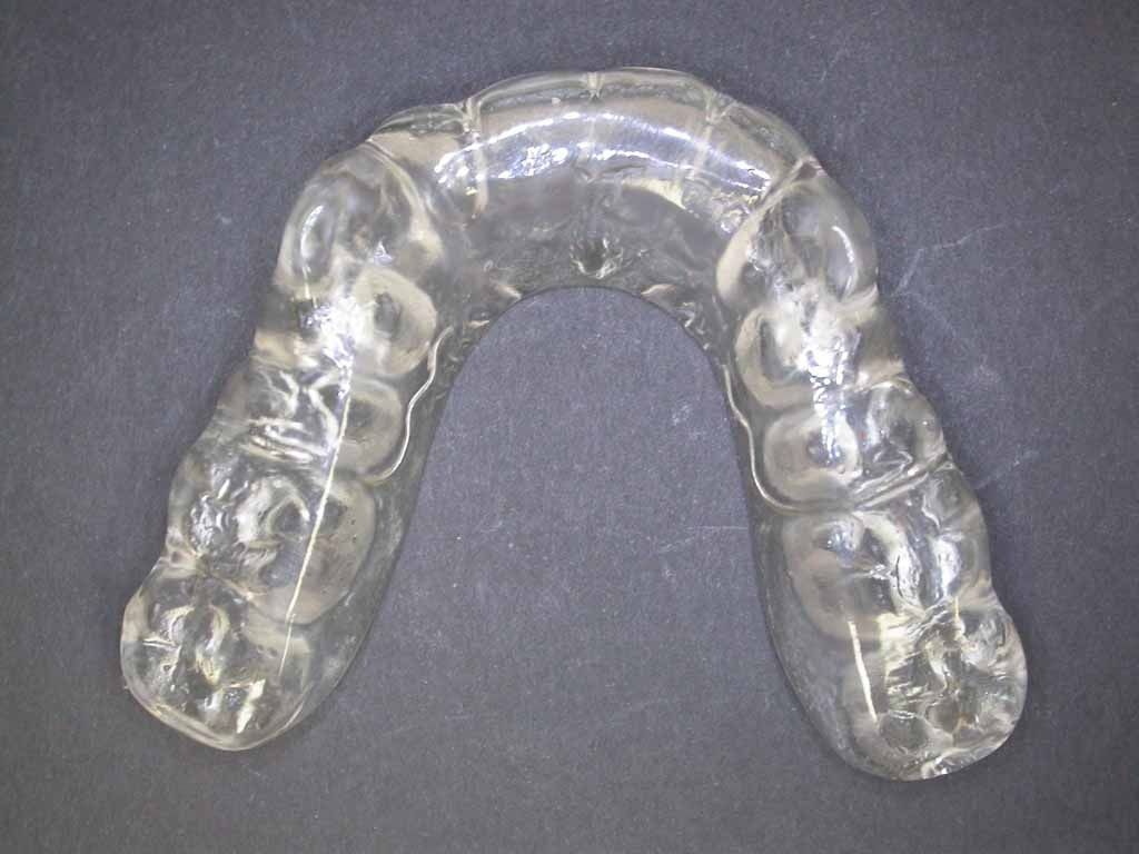 Michiganschiene Knirscherschiene - Daniel Wirz Zahnprothetik - Zürich