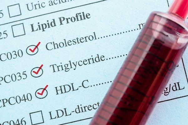 Se extrae una muestra de sangre para determinar el perfil lipídico, que incluye pruebas de colesterol, triglicéridos y HDL-C.