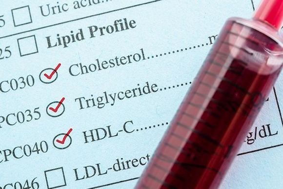 Se extrae una muestra de sangre para determinar el perfil lipídico, que incluye pruebas de colesterol, triglicéridos y HDL-C.