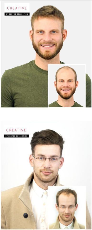 Vorher nachher Cyberhair Coiffeuse Nejla