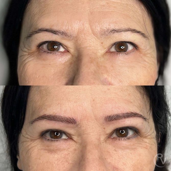 Una foto de antes y después de las cejas de una mujer.