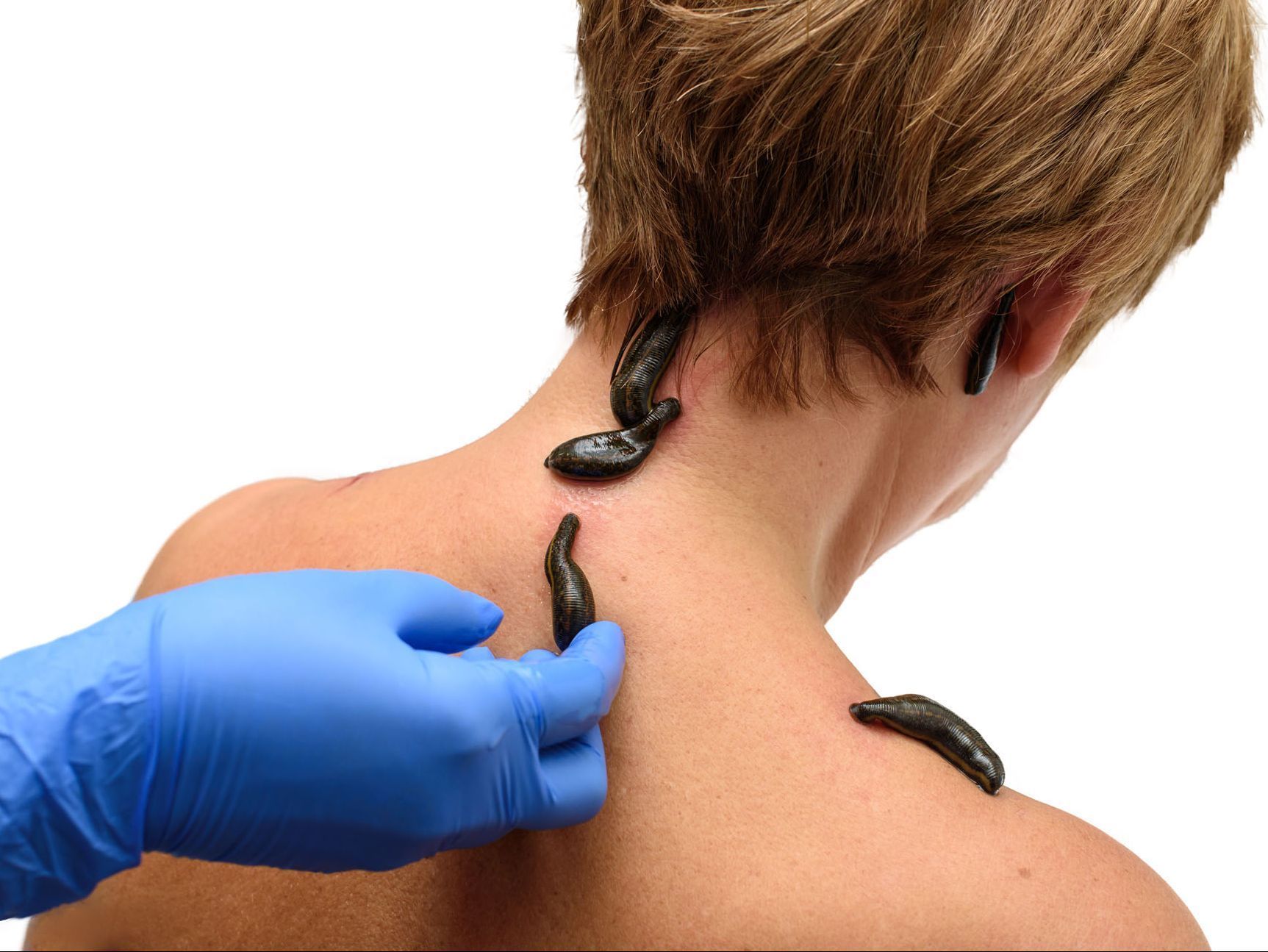 Blutegeltherapie - Naturheilpraxis in Zürich