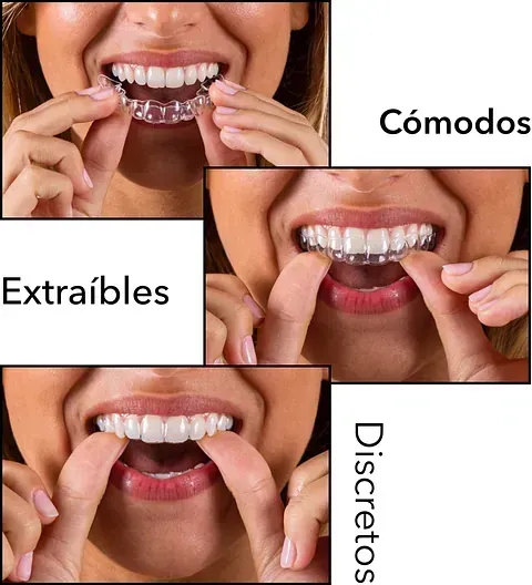 Mujer insertando y quitando alineadores transparentes; el texto dice