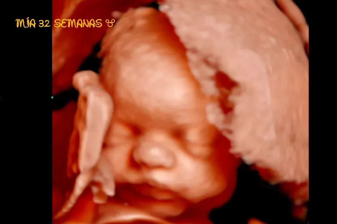 Ecografía 3D de un feto dormido en el útero, con la cara y la mano visibles.