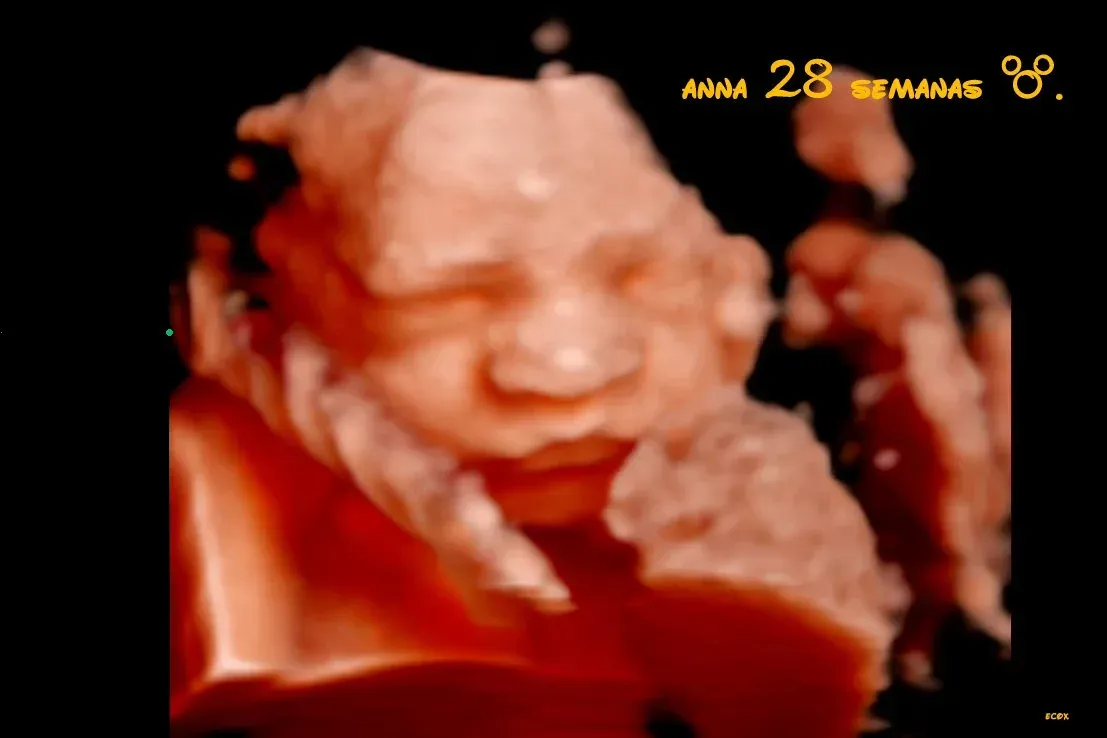 Ecografía 3D de un feto, primer plano con rostro y mano visibles, en tonos naranja cálido.