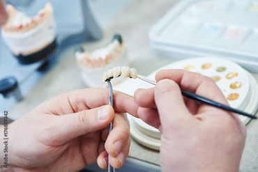 Hände bemalen in einem Dentallabor mit einem kleinen Pinsel eine Zahnbrücke.