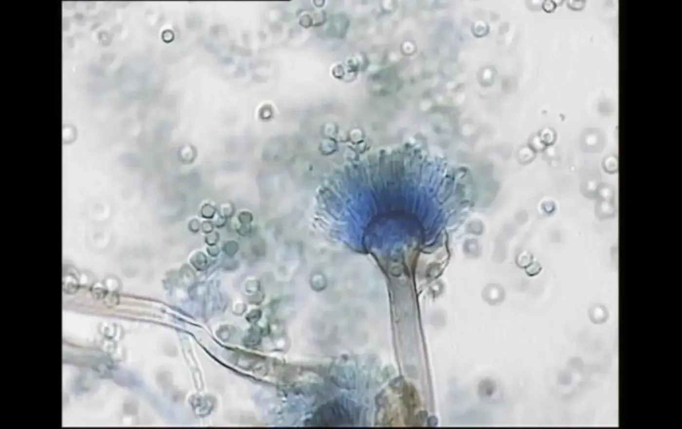 Blauschimmelpilzsporen unter dem Mikroskop: ein dichter blauer Pilzkopf und verstreute Sporen vor hellem Hintergrund.