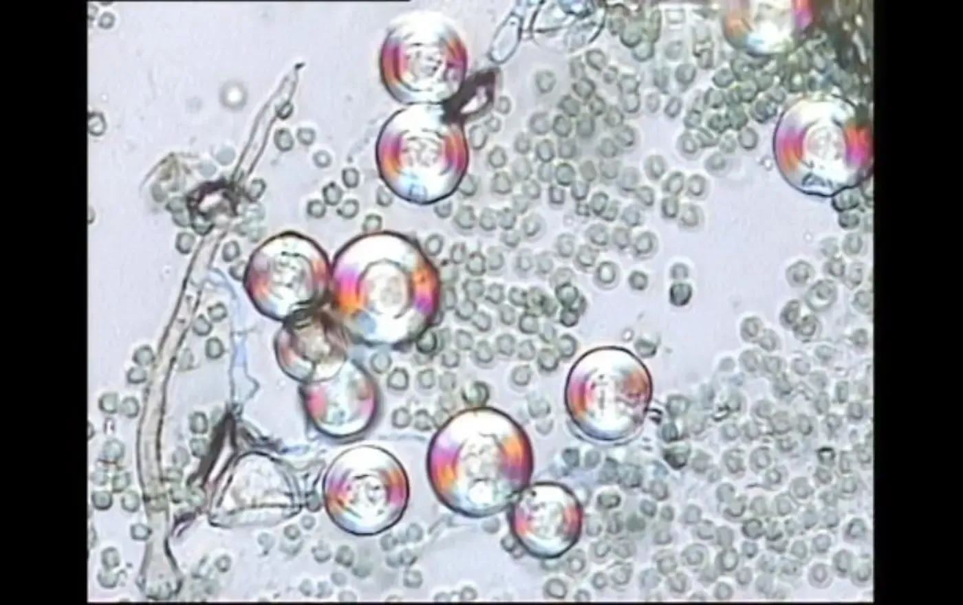 Mikroskopische Ansicht von runden, transparenten Zellen mit einigen größeren, rötlichen Bläschen und verzweigten Fasern.