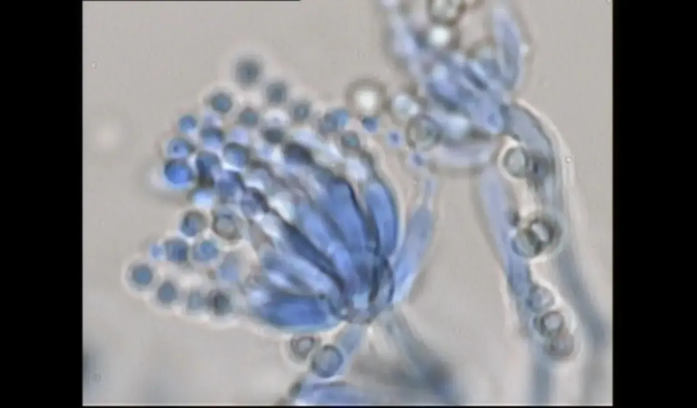 Blau gefärbte mikroskopische Ansicht von Ansammlungen von Pilzsporen und Hyphen