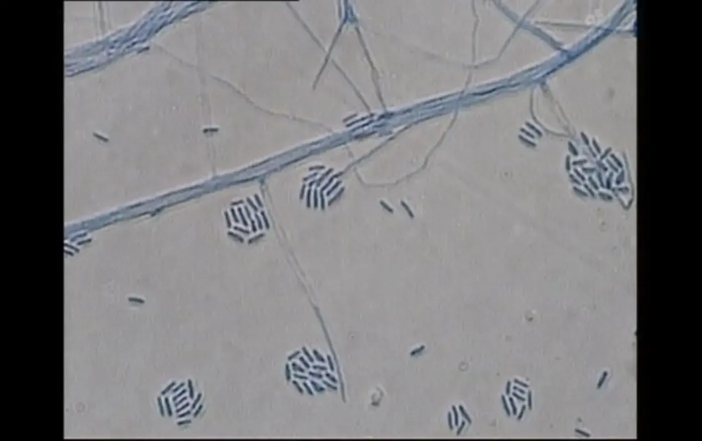 Kleine, gestreifte, blattartige Stempel sind auf einer hellbeigen Oberfläche mit einer diagonalen blauen Linie verstreut.