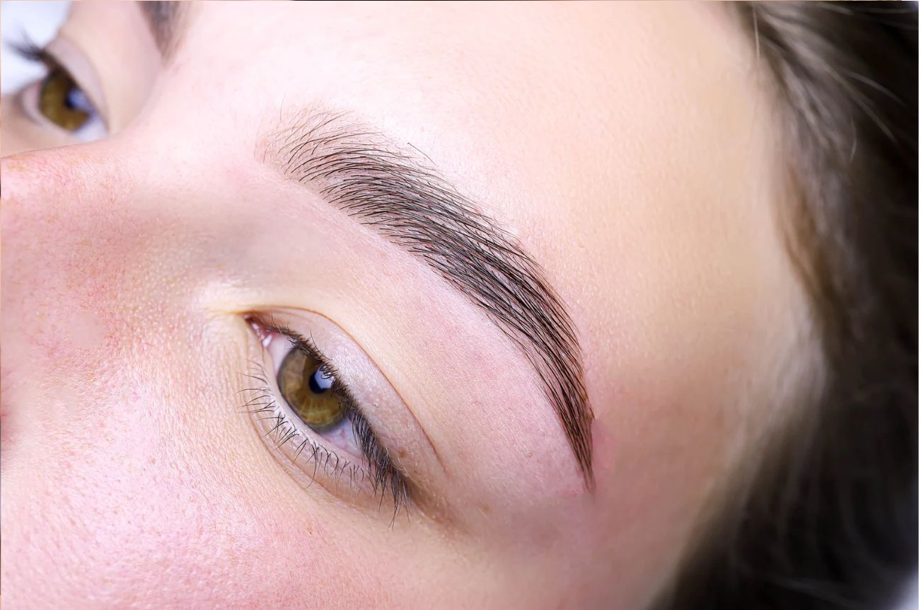 Résultat après browlift