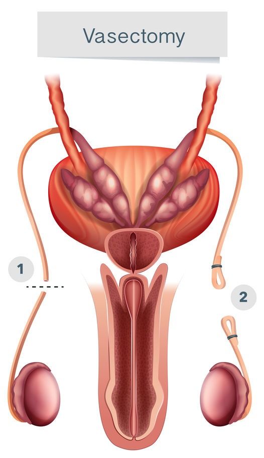 UTERO