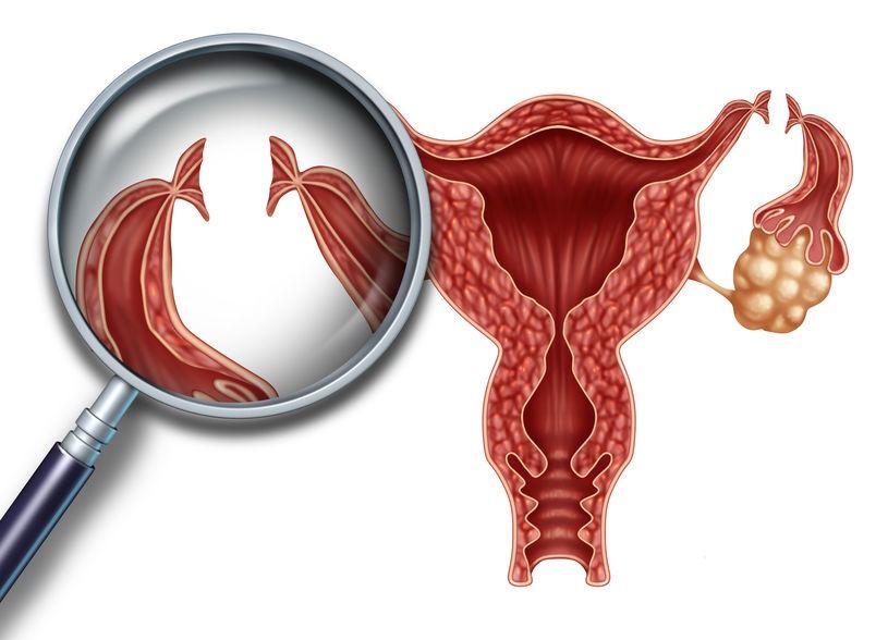 UTERO